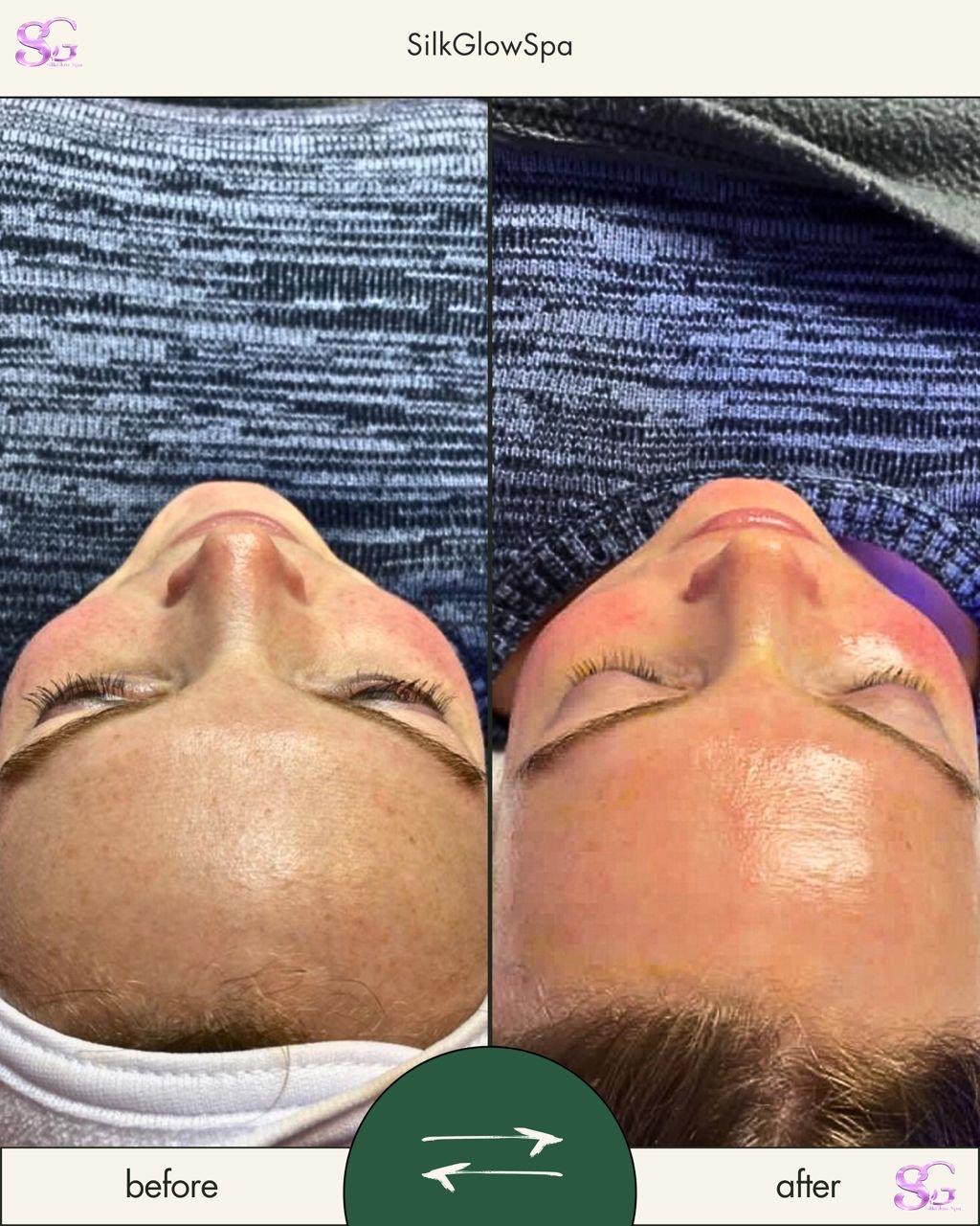 Brighter, renewed skin